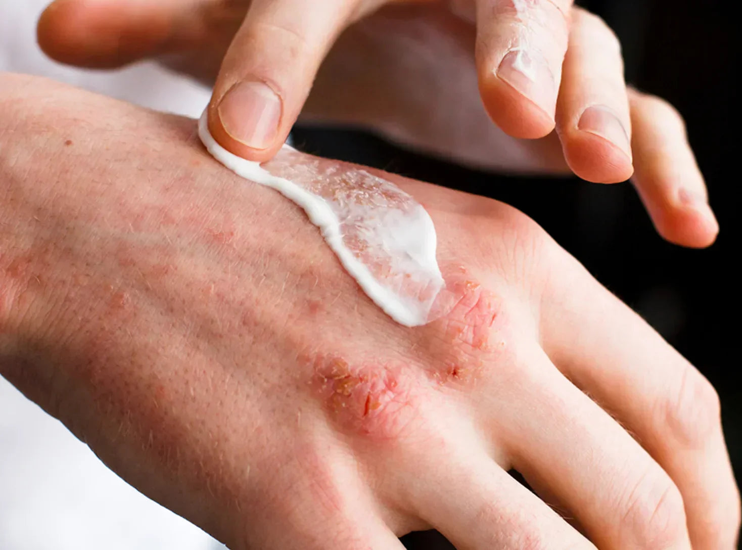 WHY YOUR ‘CALMING’ CREAM ISN’T WORKING