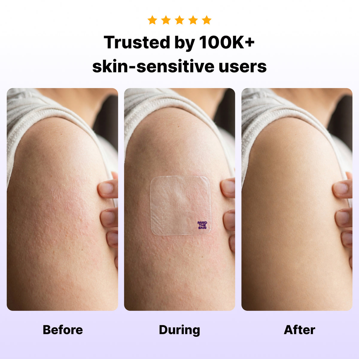 Before, during and after photos of Reset worn on an upper arm