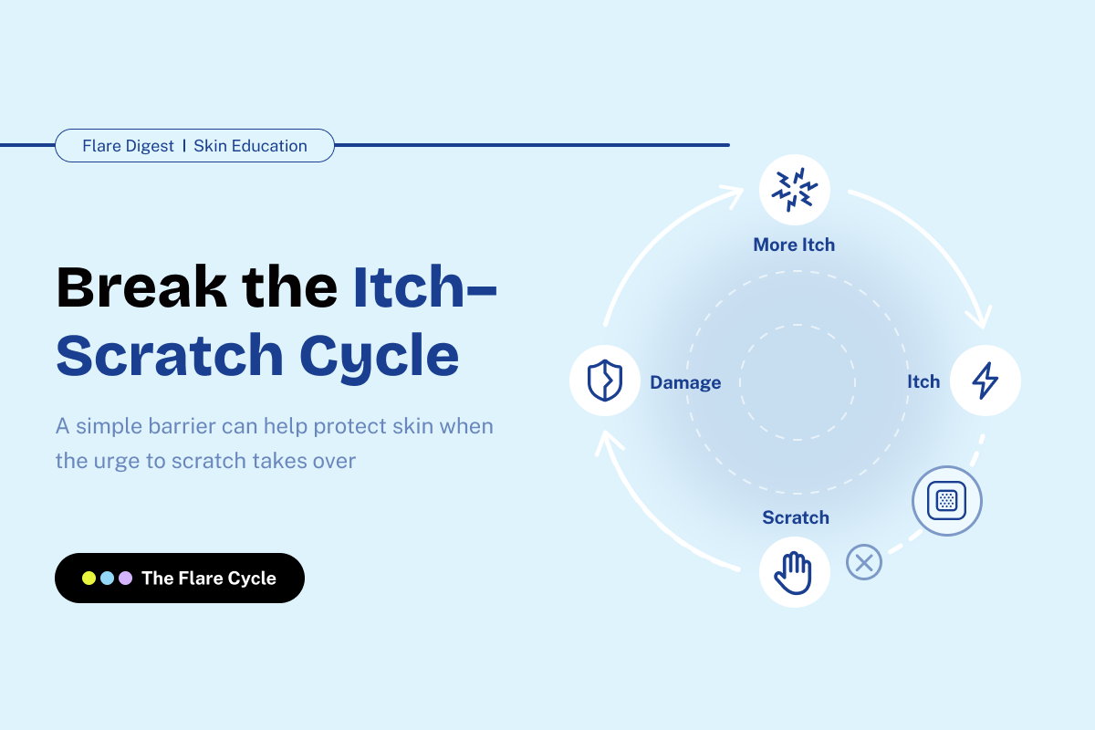 Flare Digest banner on breaking the itch-scratch cycle with a protective patch.