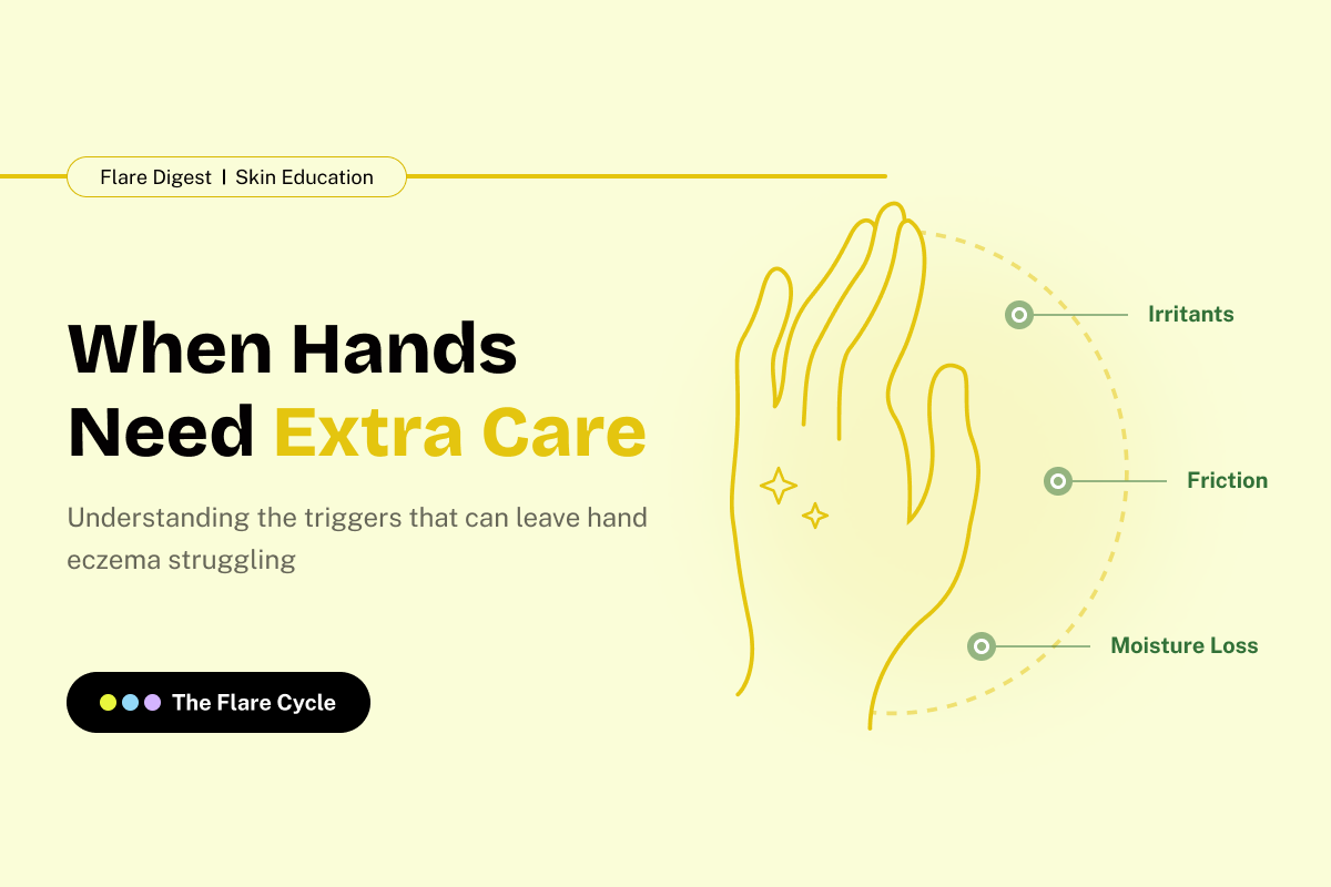 Flare Digest banner on the triggers behind hand eczema.
