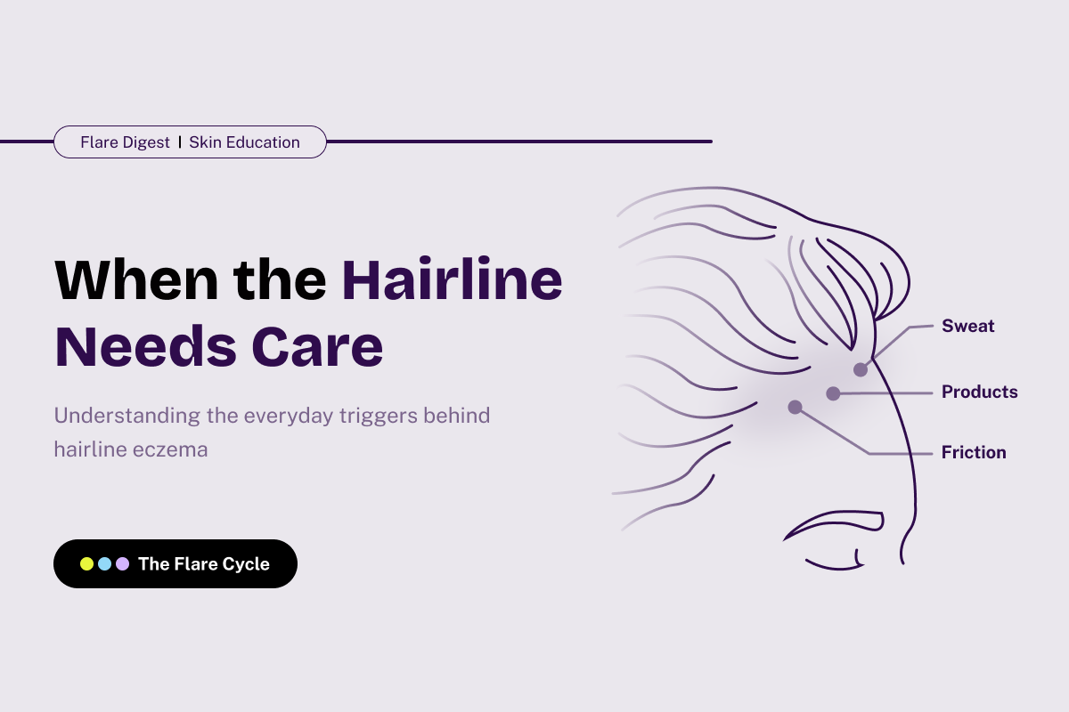 Flare Digest banner on the everyday triggers behind hairline eczema.