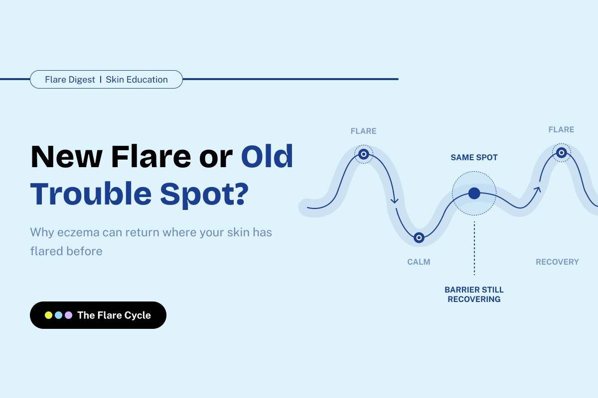 Flare Digest banner on telling a new flare from a recovering spot.