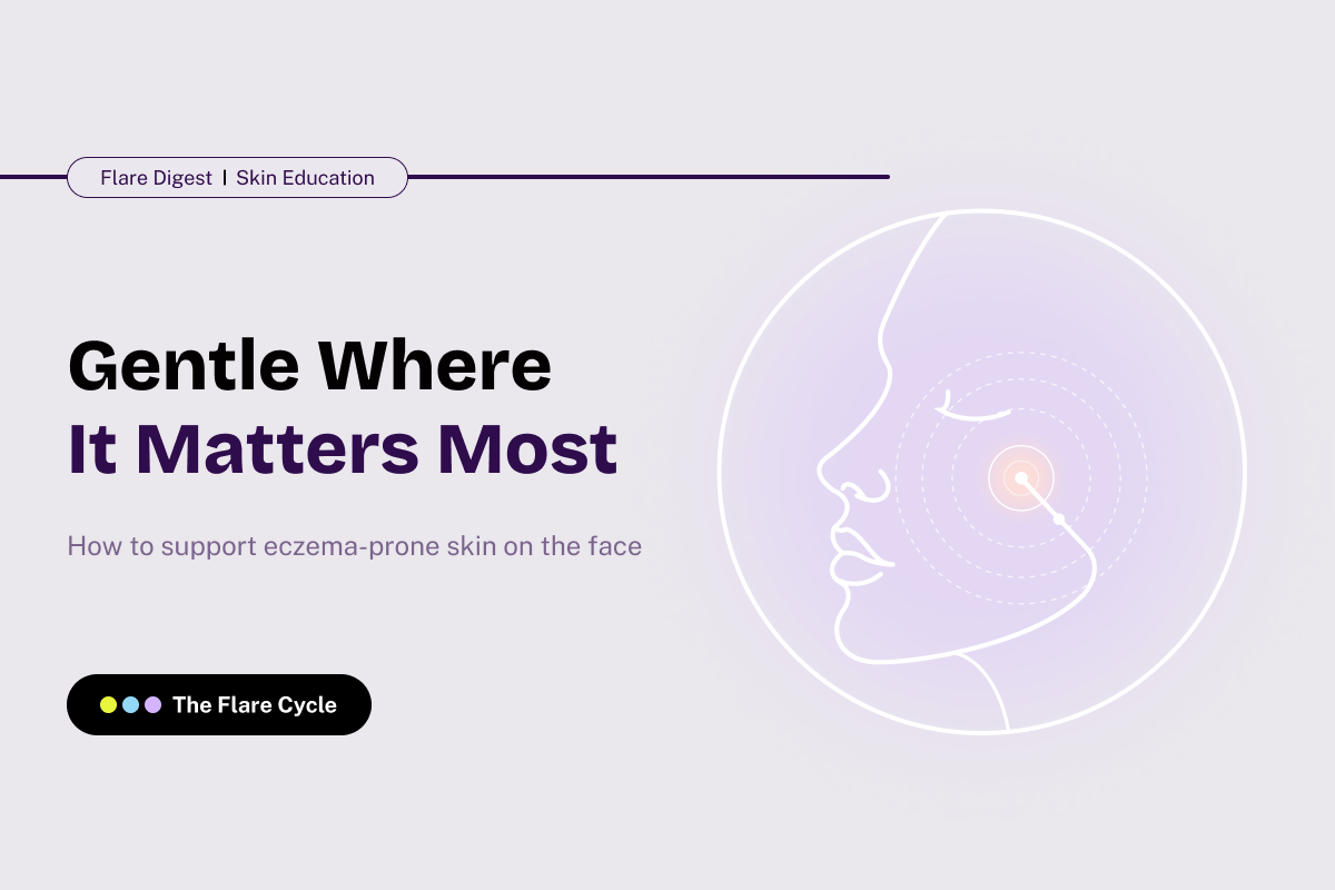 Gentle Where It Matters Most, facial eczema banner.