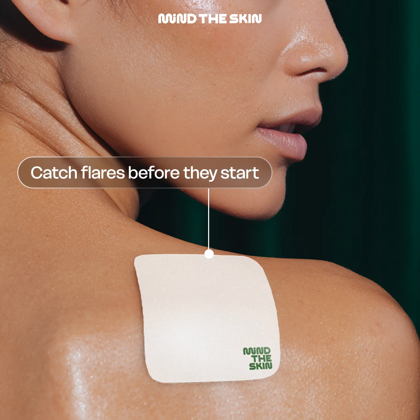 Signal Pre-Flare Patch