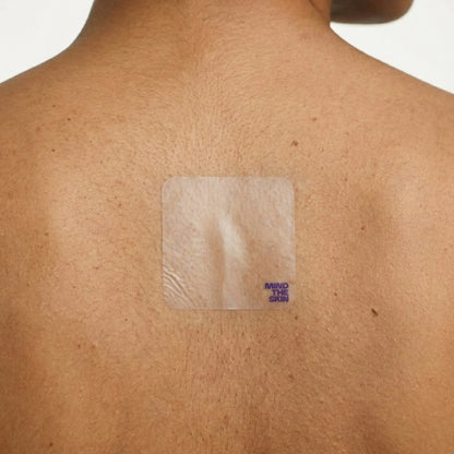 Reset Post-Flare Patch