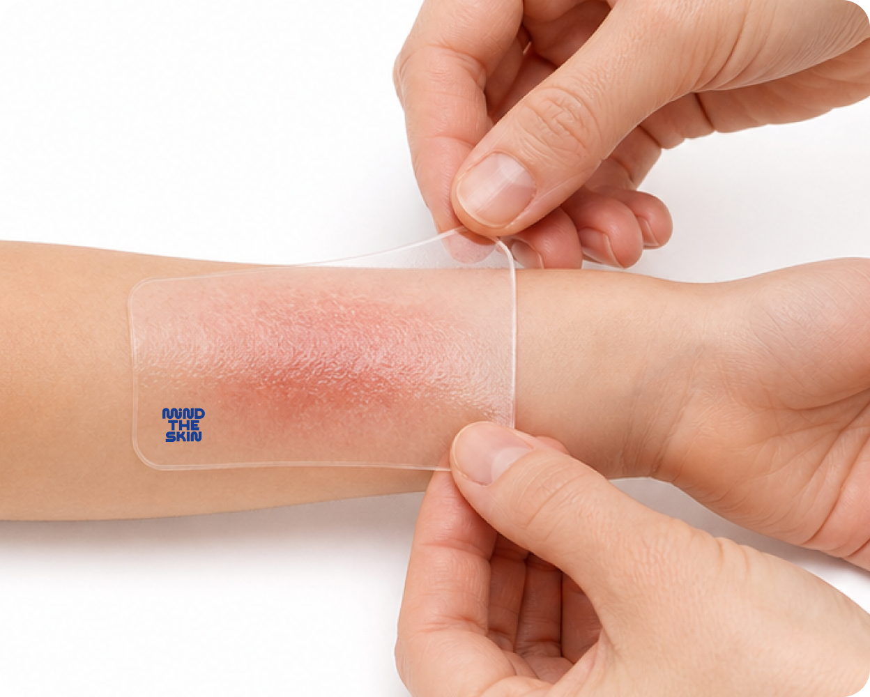 Person applying a transparent bandage to a child's arm with a visible brand logo.